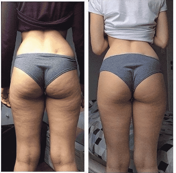Slip af med cellulite og få en fastere hud!
